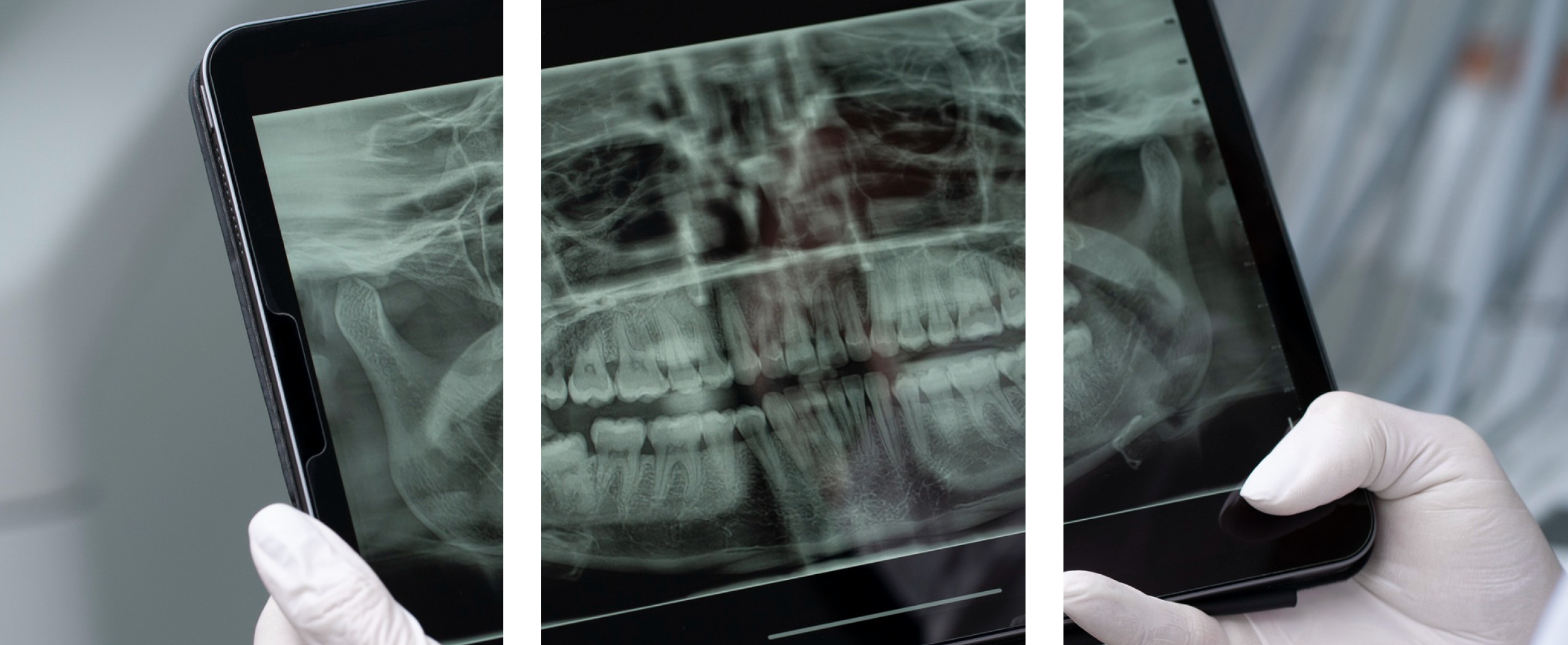 Digital X rays